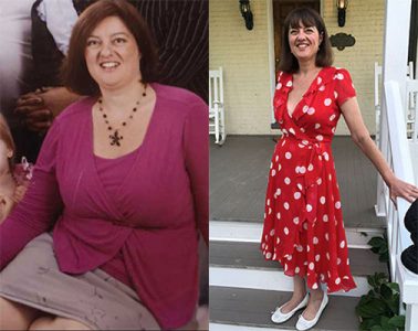 Susan Metz before and after intermittent fasting